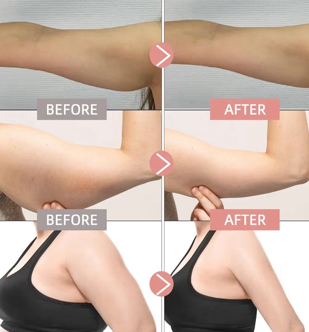 𝗚𝗟𝗣-𝟭爆紅的瘦身貼片30片/包