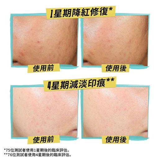 Kiehl’s 1.2% 水楊酸涼感痘痘凝膠