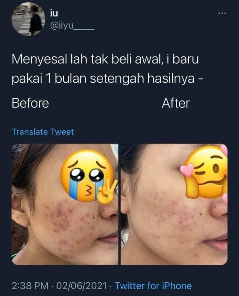 AXIS-Y 煥白淡斑亮膚精華50ml