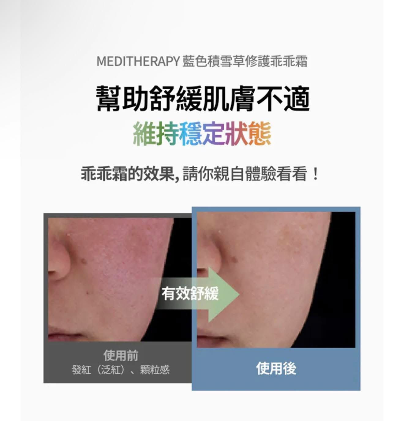 韓國 Meditherapy 藍色積雪草修護乖乖霜 100ml