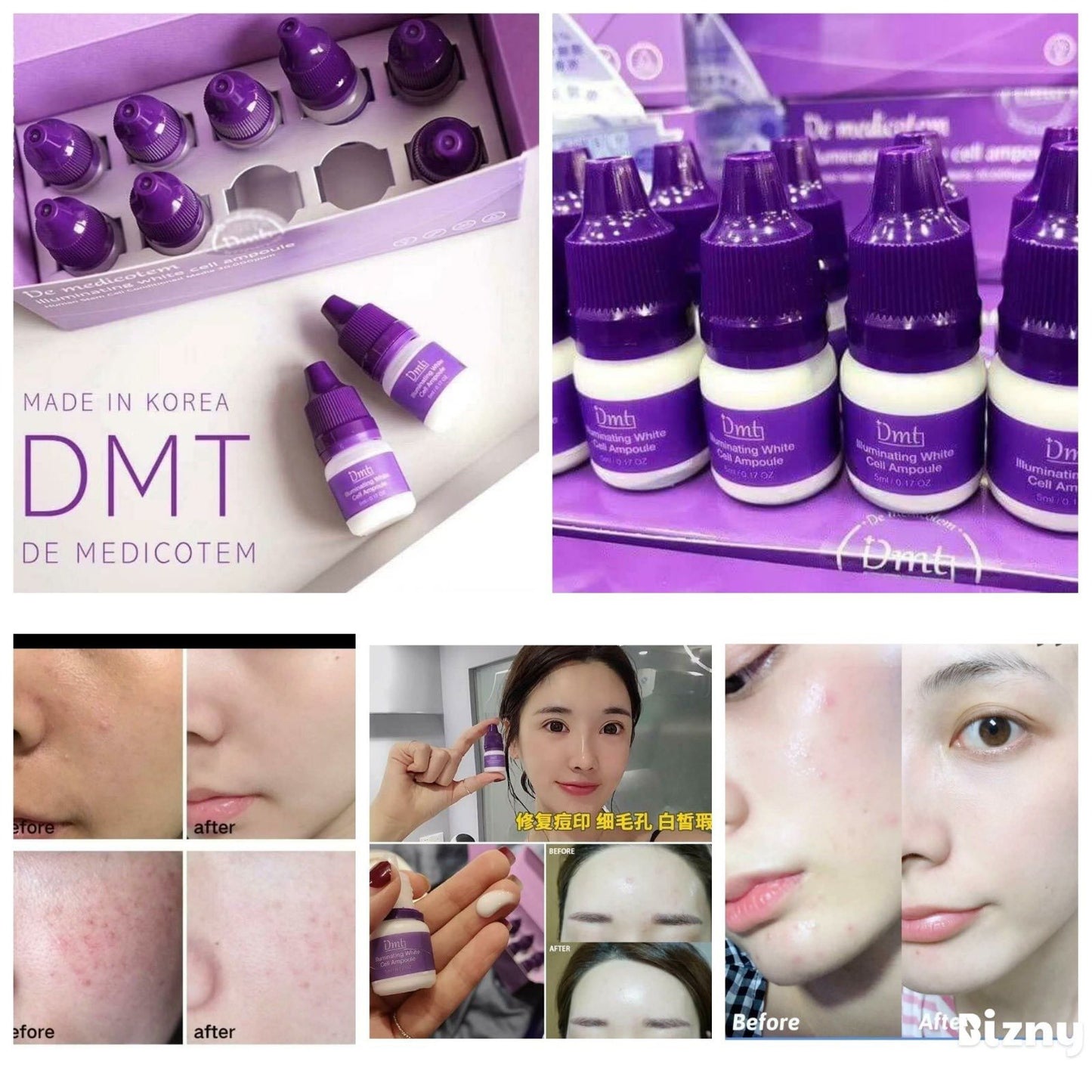 韓國醫美專用DMT幹細胞美白淡斑修護素顏滴